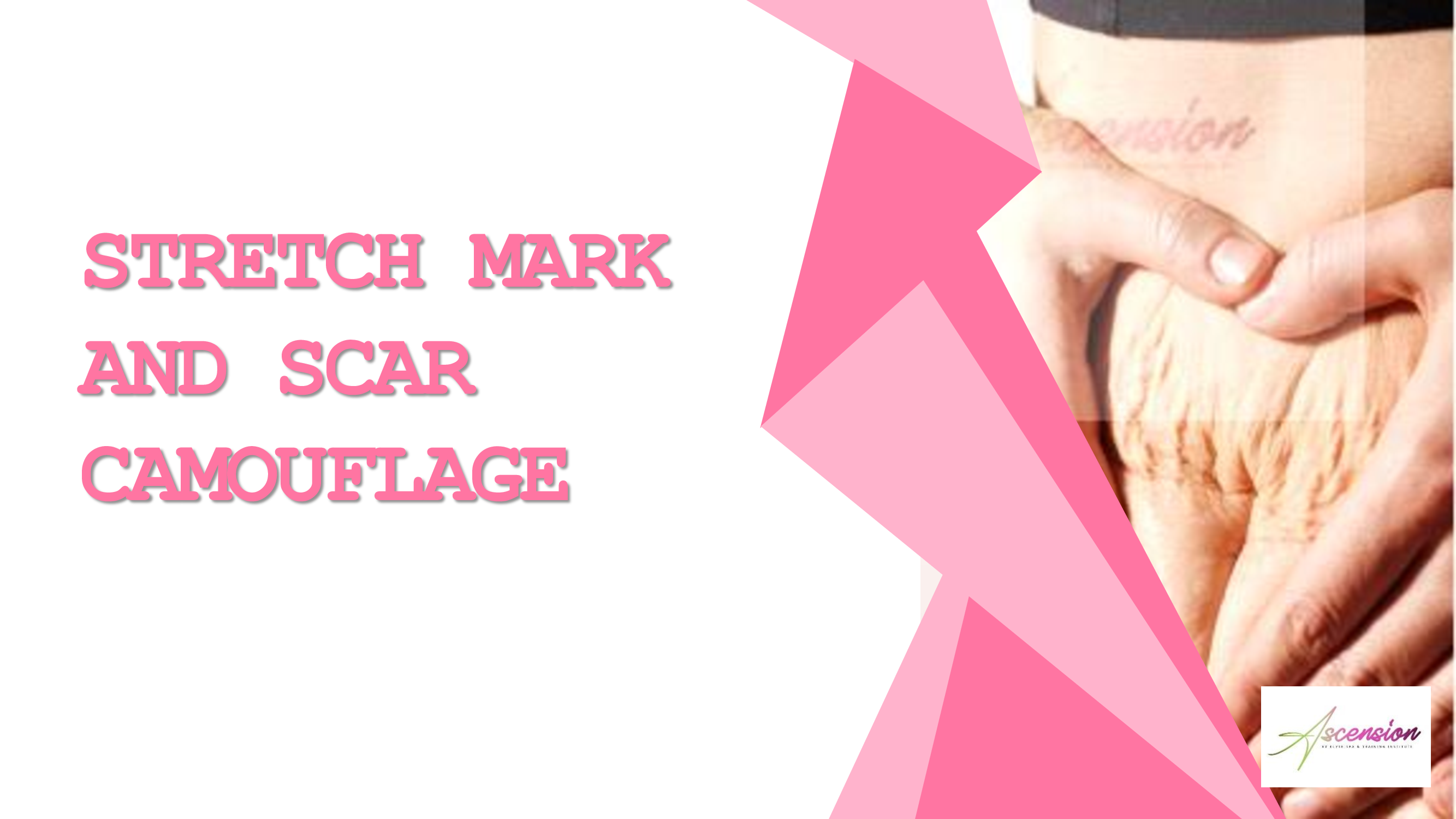 Stretch Mark and Scar Camouflage
